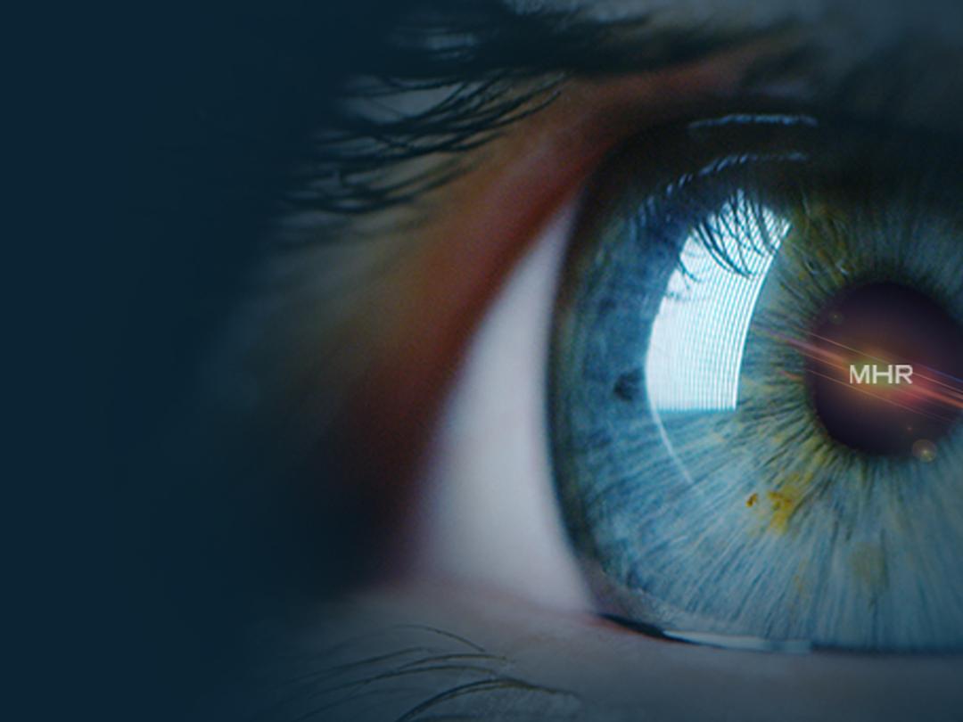blue eye close up with MHR in the pupil